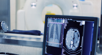 Suministros de potencia de alto voltaje para tomografía computarizada (CT)