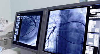 Generadores de rayos X y fuentes de rayos X Monoblock® para la producción de imágenes vasculares