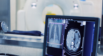 Computed Tomography